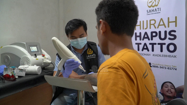 Mantap Hijrah, Puluhan Orang Berbondong Ingin Hapus Tato