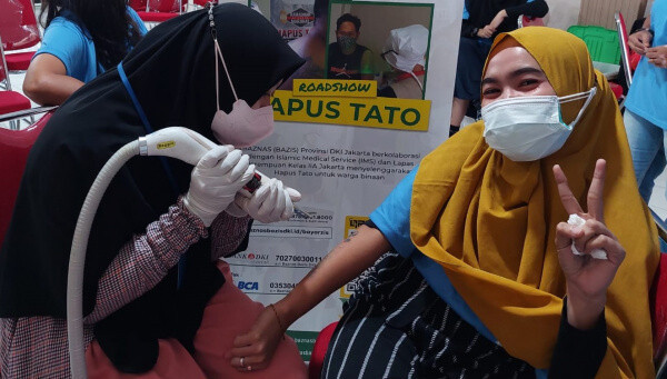Ramadhan, BAZIS DKI-IMS Berikan Layanan Hapus Tato untuk 34 Warga Binaan Pemasyarakatan