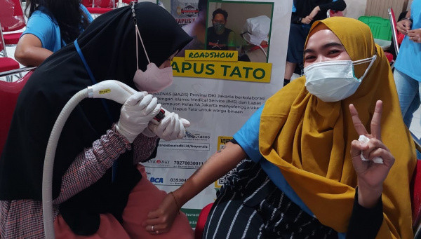 Ramadhan, BAZIS DKI-IMS Berikan Layanan Hapus Tato untuk 34 Warga Binaan Pemasyarakatan